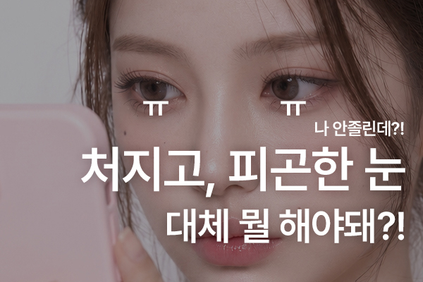 졸린 눈, 처진 눈… 눈매교정이 필요한 눈일까요?