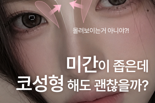 미간이 좁은 얼굴의 코성형 콧대 디자인